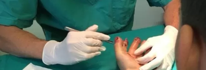 mano ferita