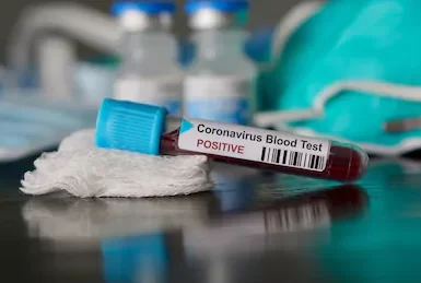 coronavirus-condizioni-26enne-san-salvatore-telesino