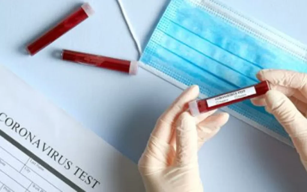 coronavirus-nuovo-caso-san-nicola-la-strada-30-agosto