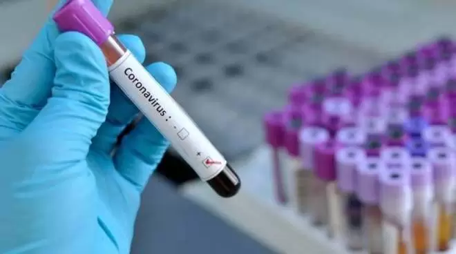 coronavirus-caso-positivo-montoro-8-settembre