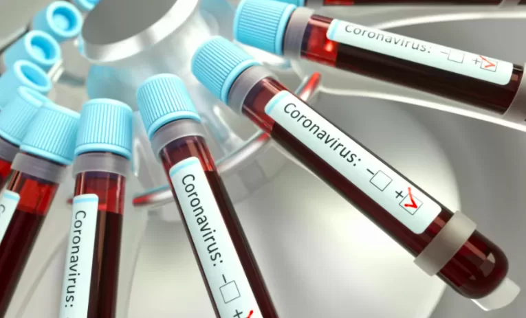 coronavirus-irpinia-25-contagi-bollettino-9-ottobre