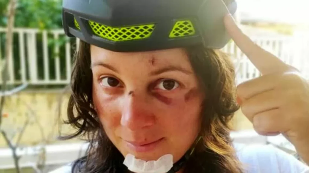 incidente monopattino candidata