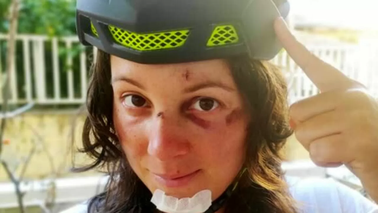 incidente monopattino candidata