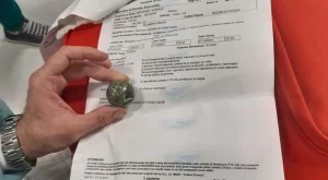 pallina-ingoiata-bambino-napoli-cto