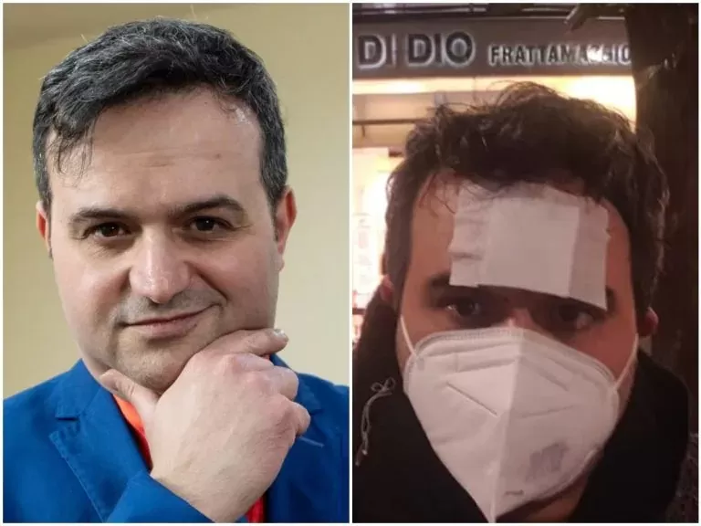 prof picchiato casavatore aggressori
