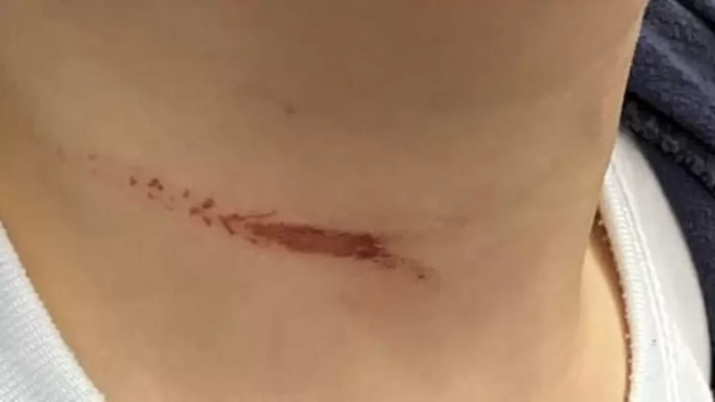 pomigliano bimbo rischia impiccato altalena