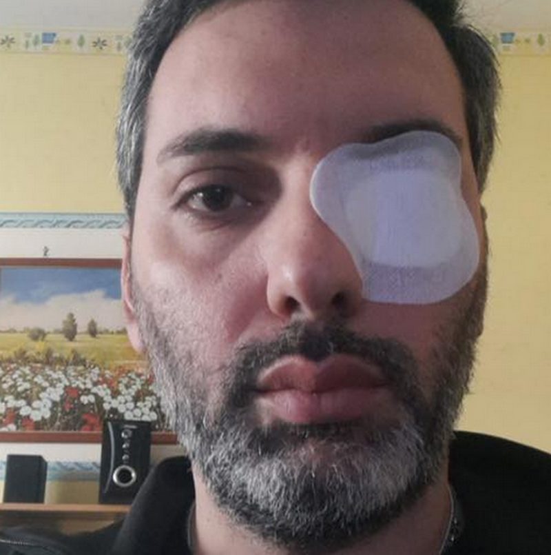disabile preso pugni posto auto arzano