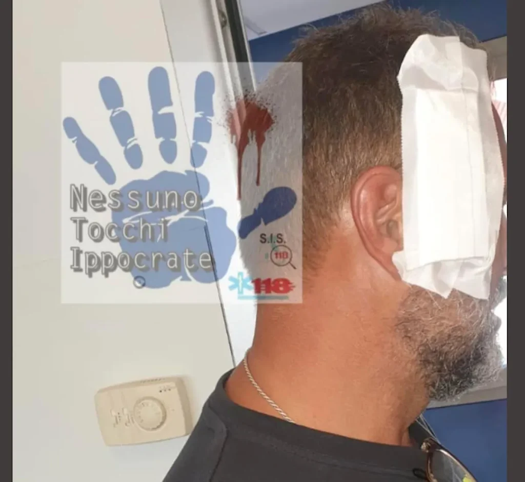 napoli infermiere preso pugni