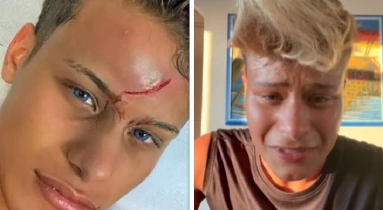 Denis Dosio denuncia 27enne giovane viene assolto