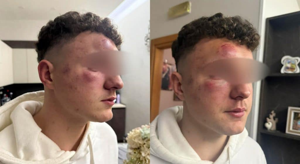 aversa aggredito denuncia borrelli 23 febbraio