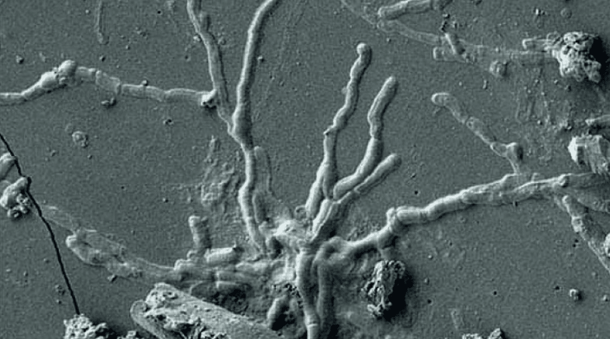 svelato mistero cervello vetrificato scavi ercolano