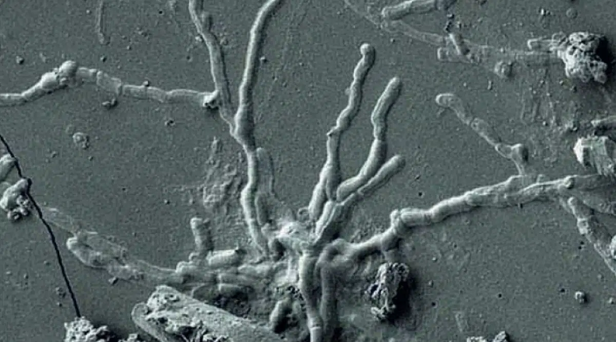 svelato mistero cervello vetrificato scavi ercolano