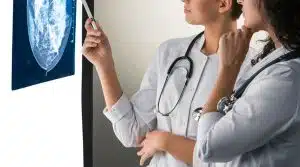 tumori scoperti tardi provincia salerno dati adesione screening