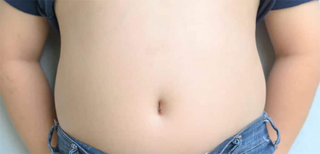 obesità infantile campania primo studio