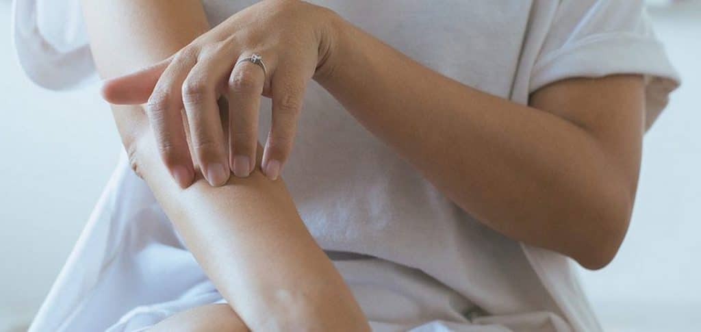 campania terapia acne inversa idrosadenite suppurativa