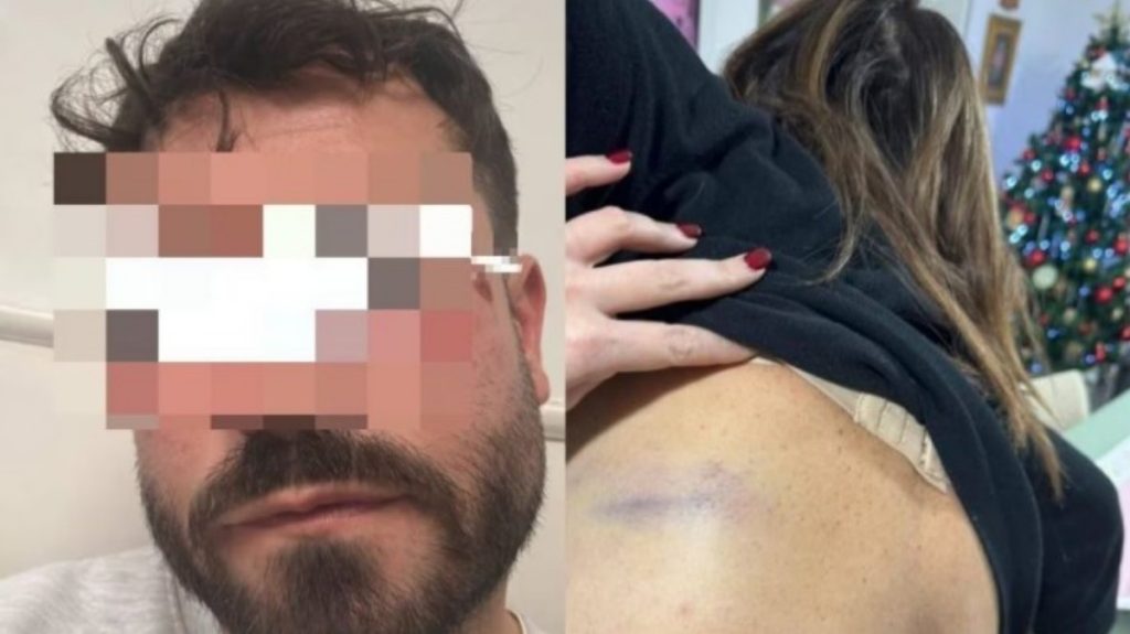 portici aggressione santo stefano