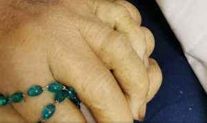 Napoli, muore anziana al San Paolo: sparisce la fede nuziale dalla sua mano