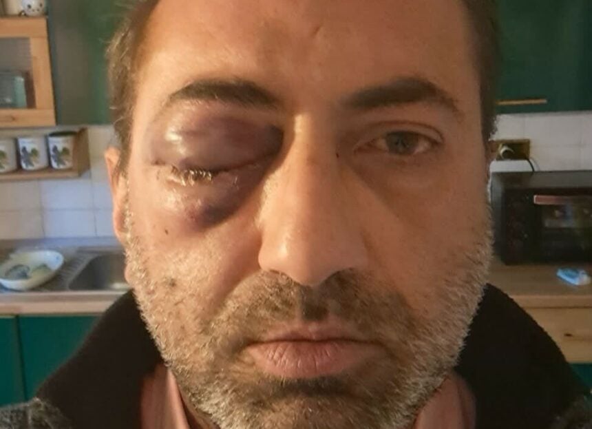 capodanno-medico-aggredito-vallo-della-lucania