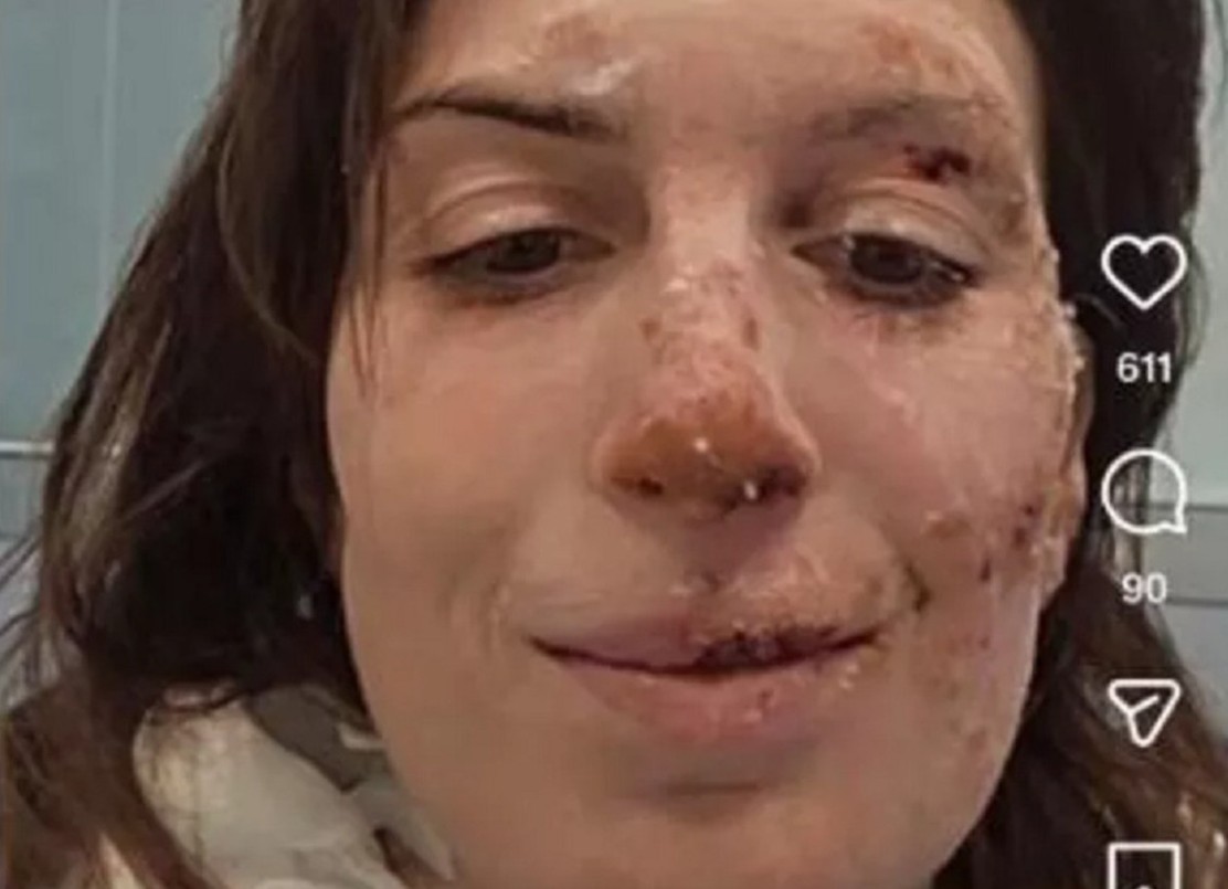 eleonora palmieri incendio crans-montana